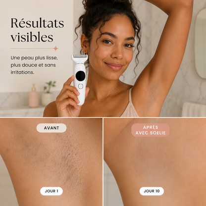 Rasoir électrique 5-en-1 pour femme — Soelie